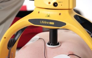 defibtech arm